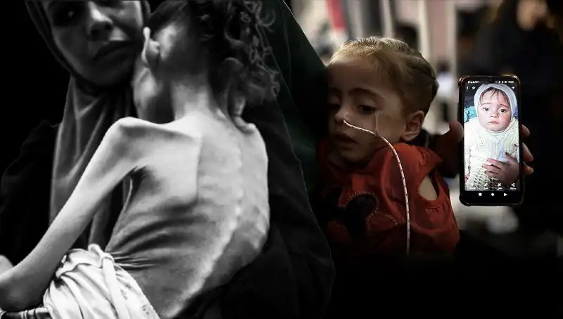 25 Kilodan 10 Kiloya Düşen Meryem'in Açlıkla Mücadelesi